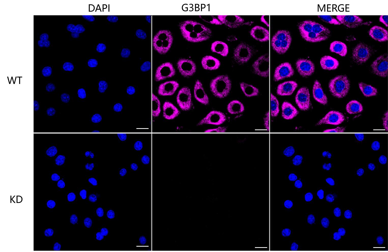 G3BP1 Antibody (24GB4575)