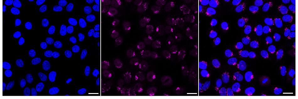 Somatostatin R5/SSTR5 Antibody (24GB2600)