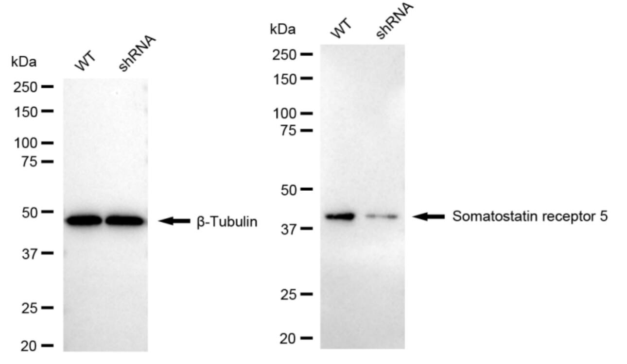 Somatostatin R5/SSTR5 Antibody (24GB2600)