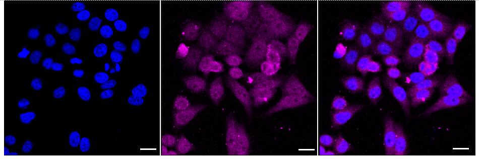 SMYD3 Antibody (24GB2260)