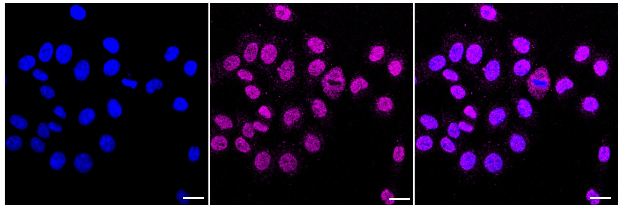 Ferritin Heavy Chain Antibody (23GB1860)