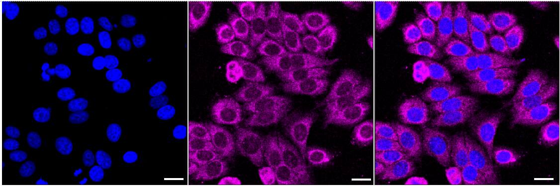 UQCRFS1 Antibody (24GB2460)