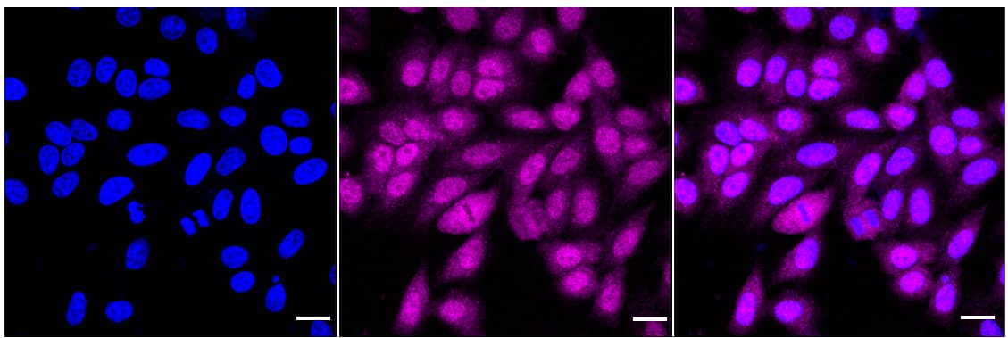 UbcH7/UBE2L3 Antibody (24GB1875)