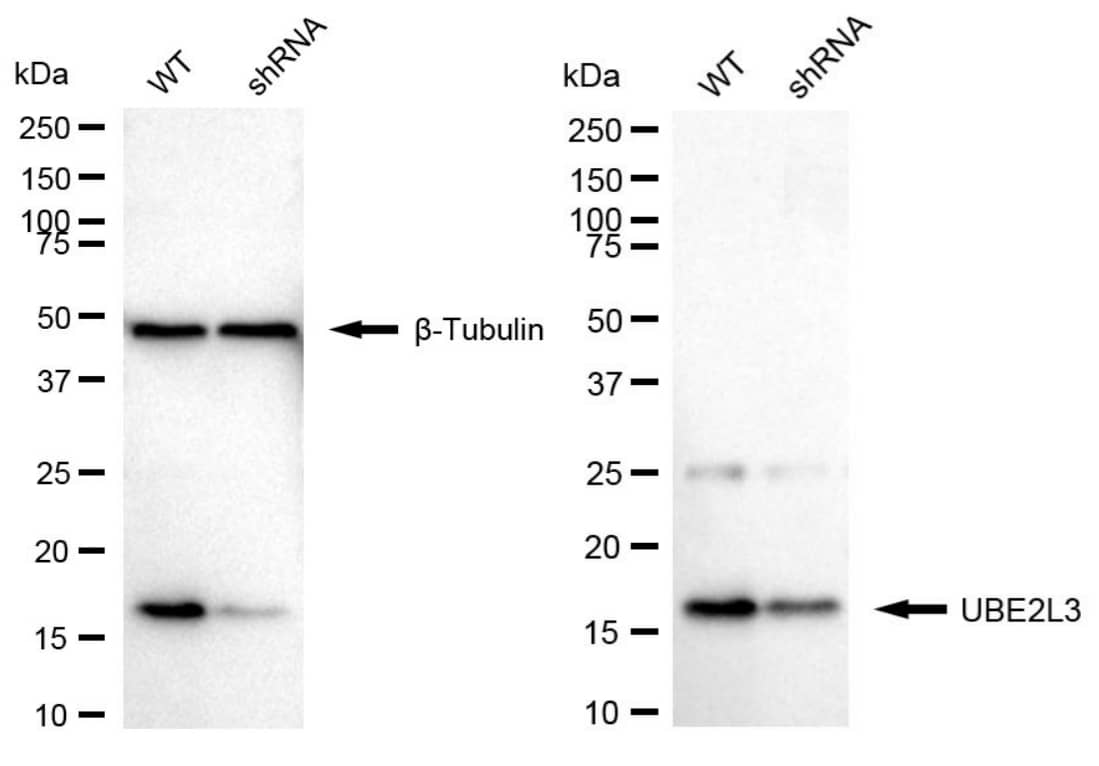 UbcH7/UBE2L3 Antibody (24GB1875)