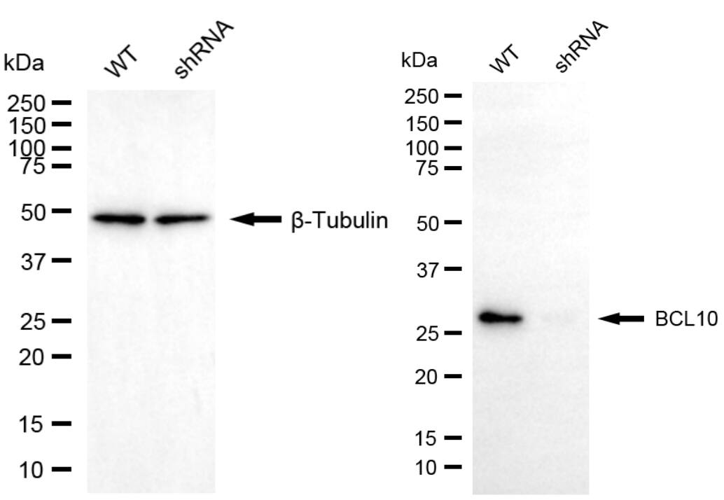 Bcl-10 Antibody (24GB2925)