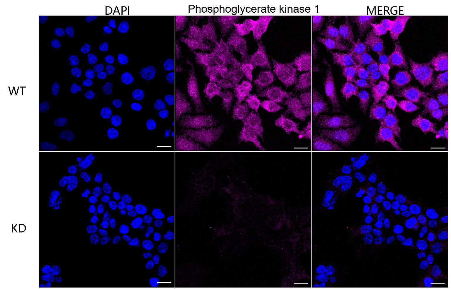 PGK1 Antibody (24GB2935)