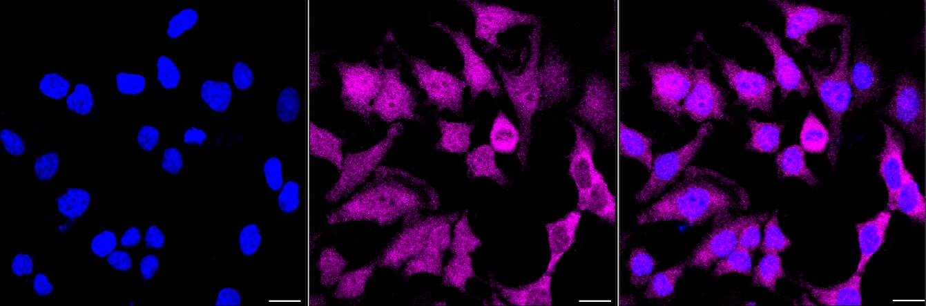 PGK1 Antibody (24GB2935)