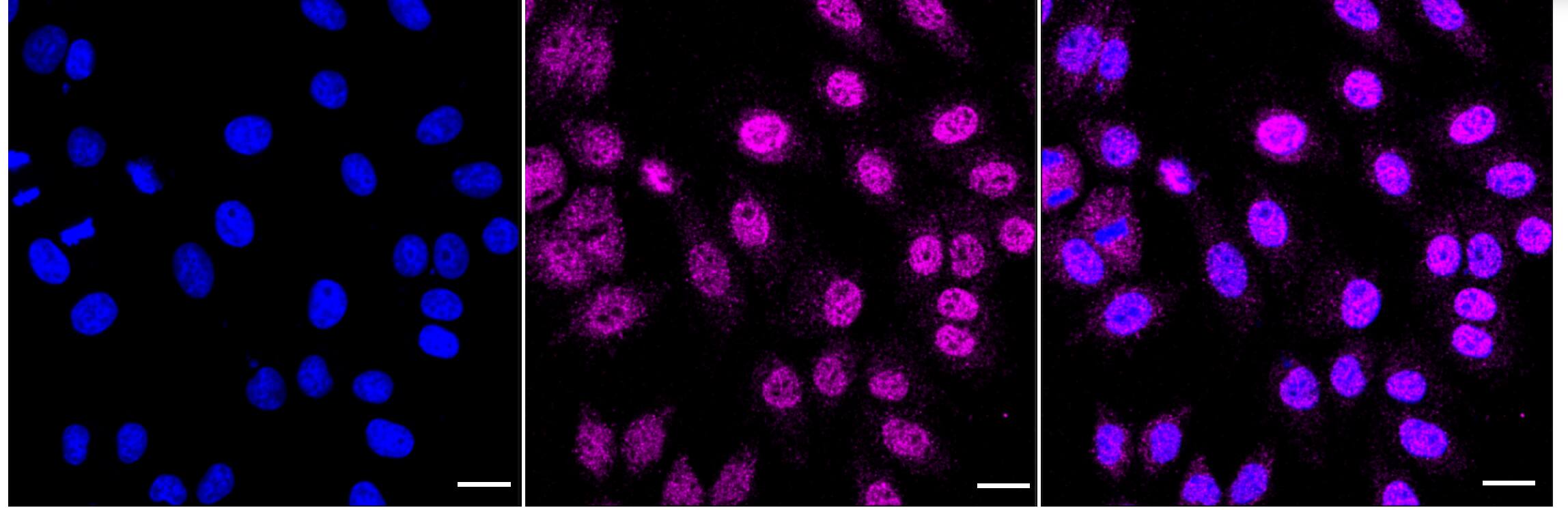 TOR/mTOR Antibody (24GB3755)