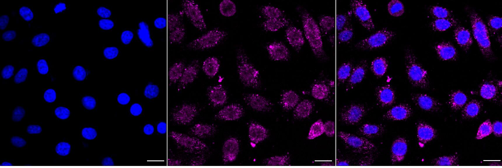 Integrin alpha V/CD51 Antibody (24GB4430)