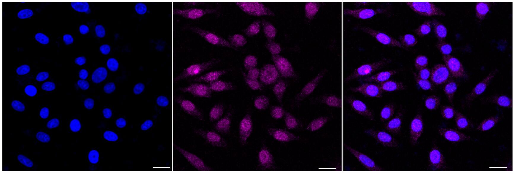 MLKL Antibody (24GB4615)