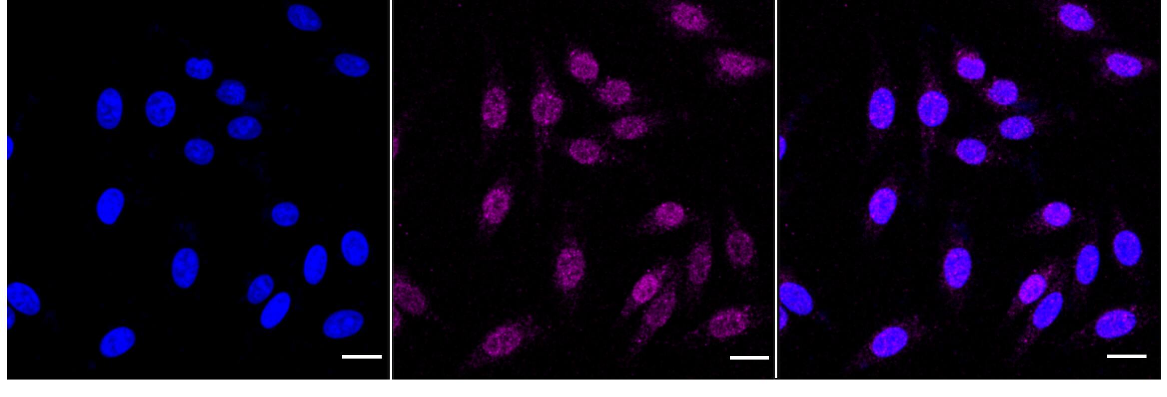 MLKL Antibody (24GB4620)