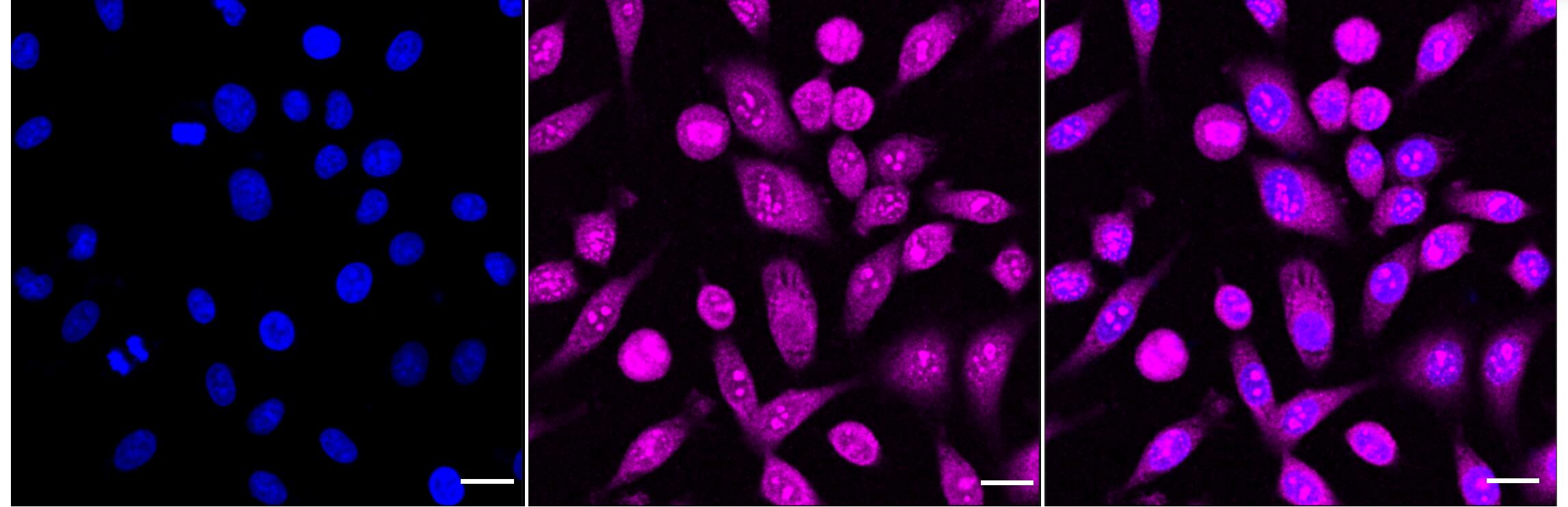 TBK1 Antibody (24GB4640)