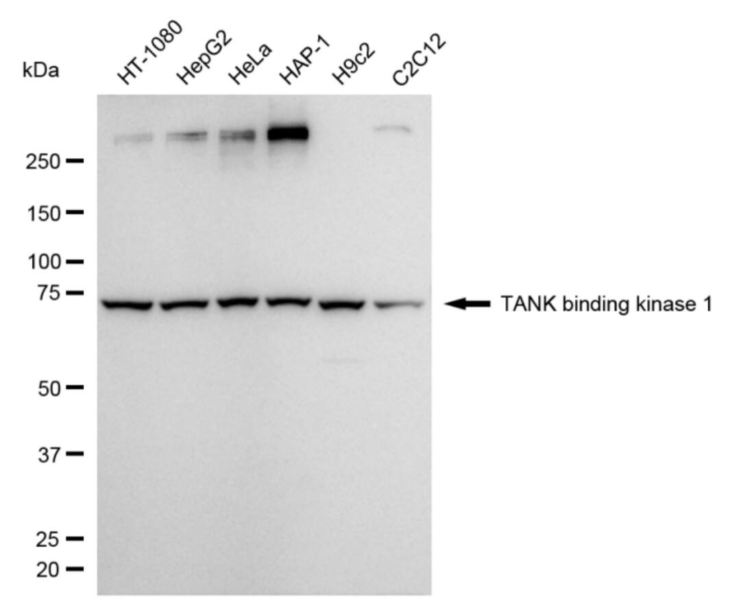 TBK1 Antibody (24GB4640)