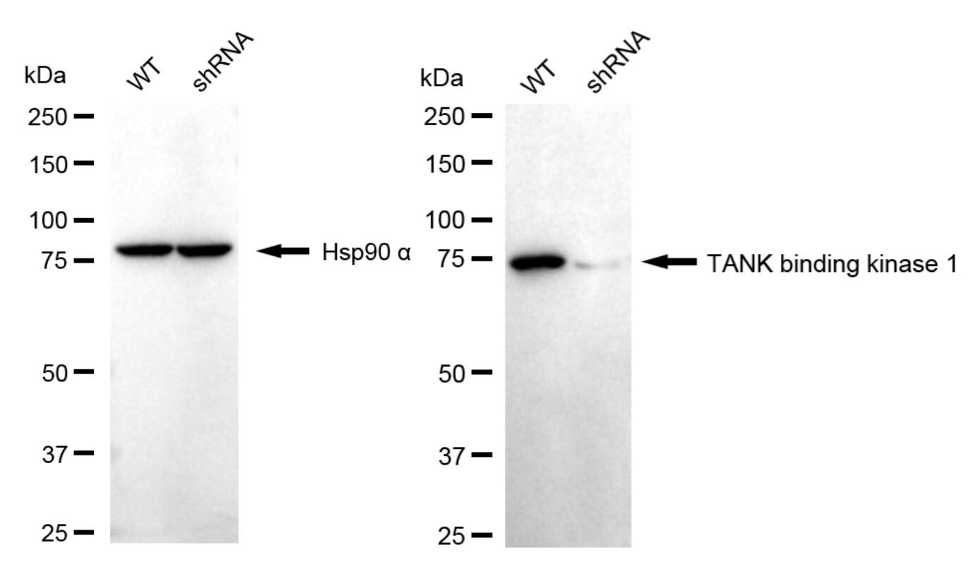 TBK1 Antibody (24GB4640)