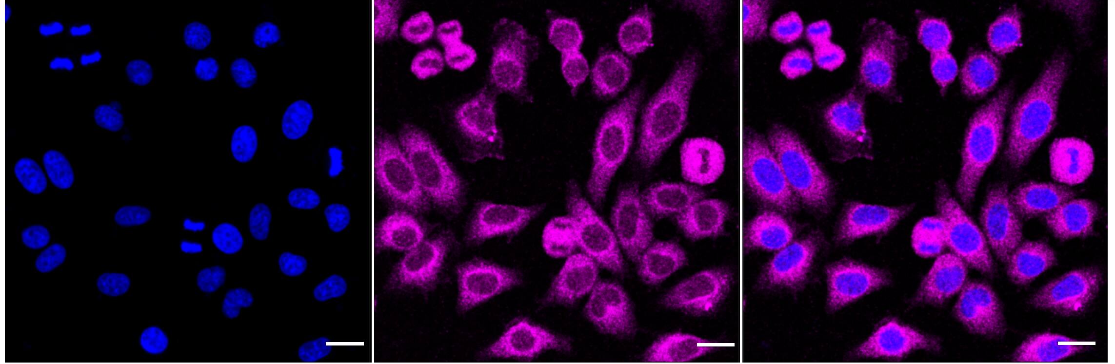 TBK1 Antibody (24GB4650)