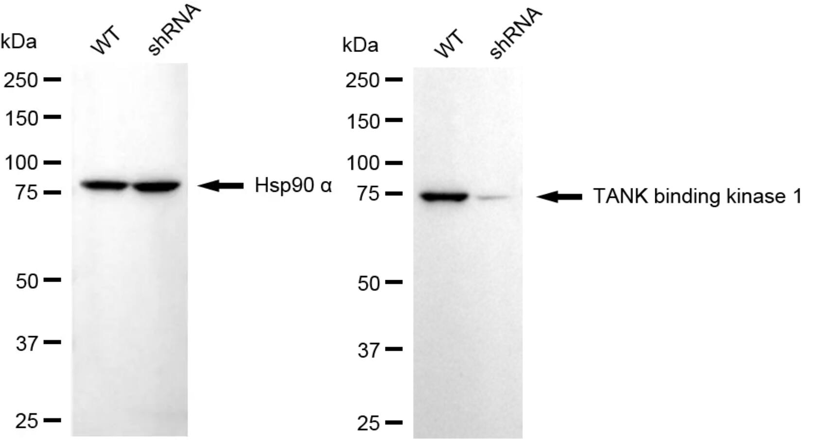 TBK1 Antibody (24GB4650)