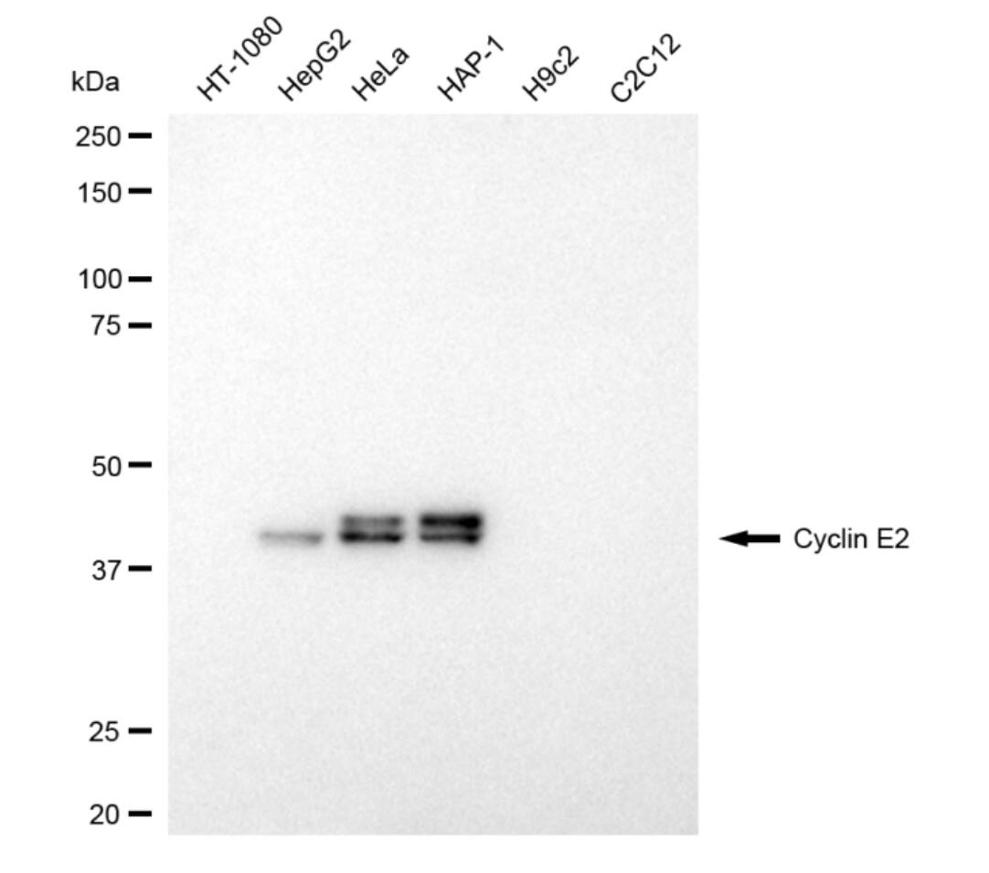 Cyclin E2 Antibody (24GB4750)