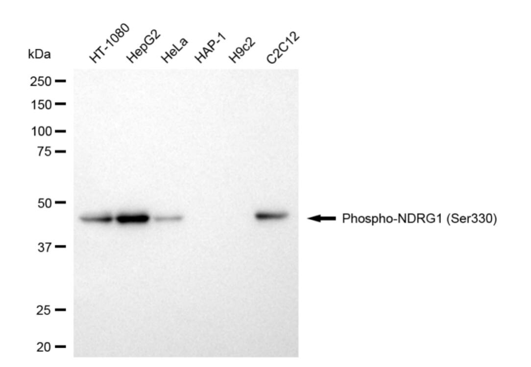 NDRG1 [p Ser330] Antibody (24GB4985)