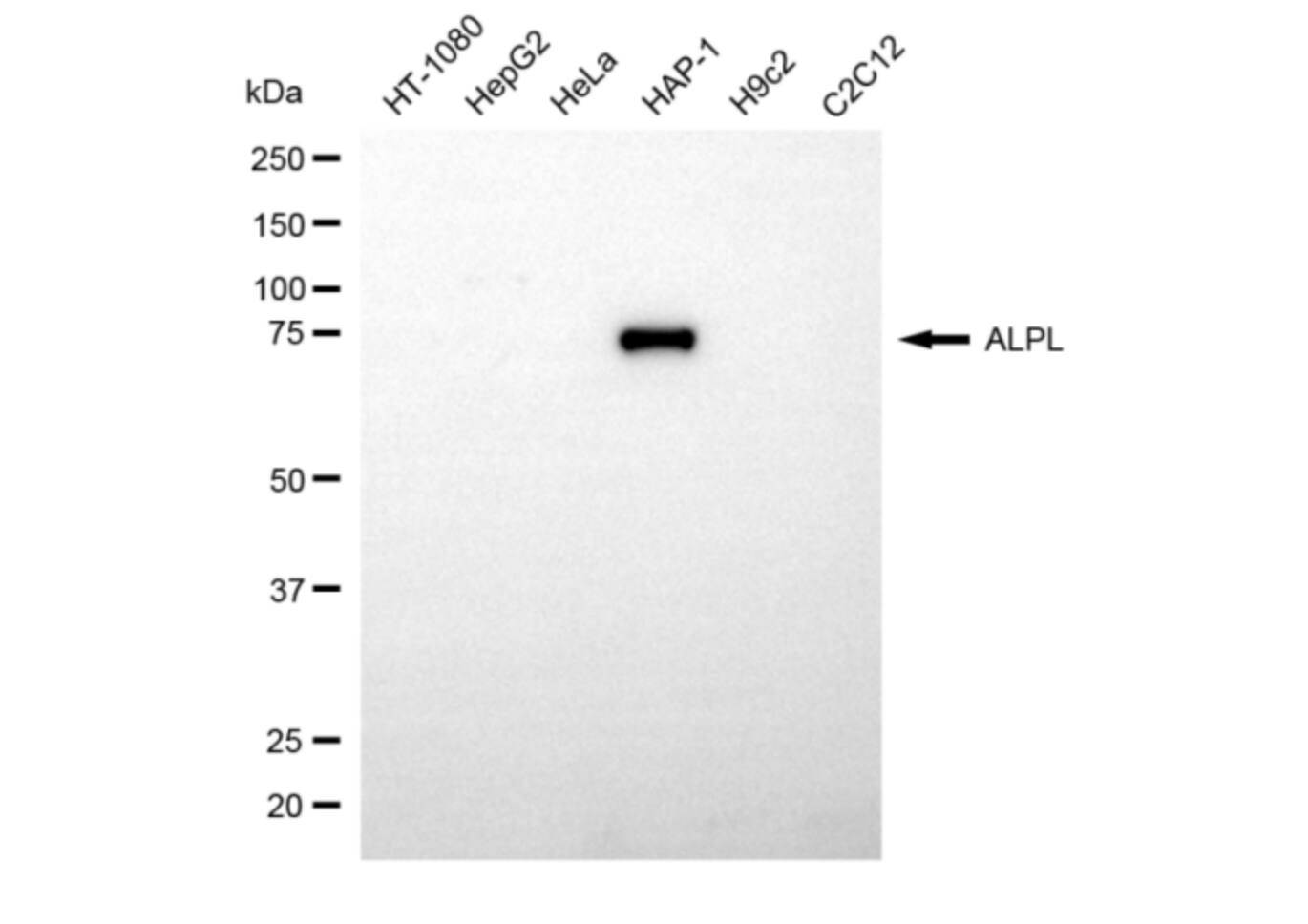 Alkaline Phosphatase/ALPL Antibody (24GB5855)