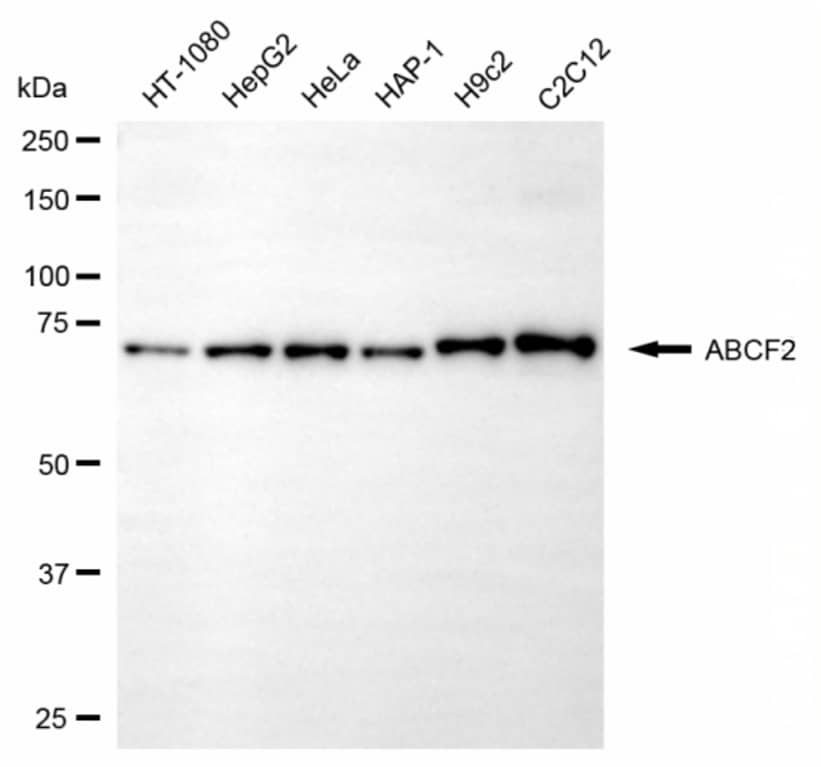 ABCF2 Antibody (24GB6635)