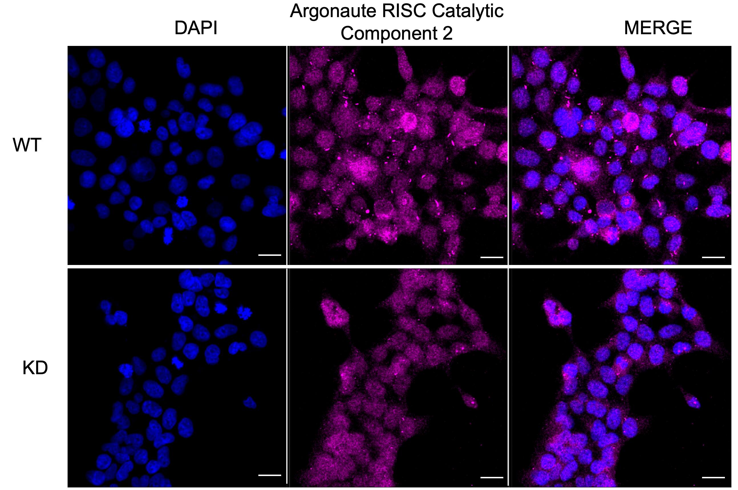 Ago2/eIF2C2 Antibody (23GB1790)