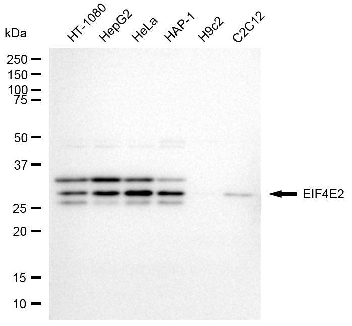 EIF4E2 Antibody (24GB8140)