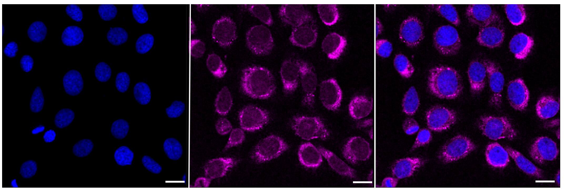 PCAF Antibody (23GB910)
