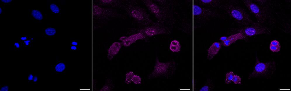 ACTR2 Antibody (23GB610)