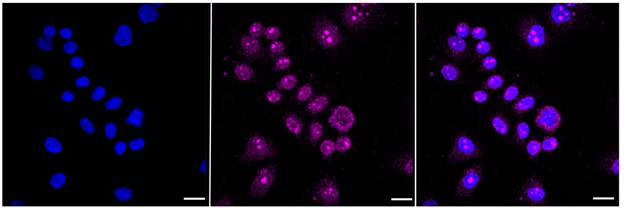 GSK-3 alpha/beta Antibody (23GB1100)
