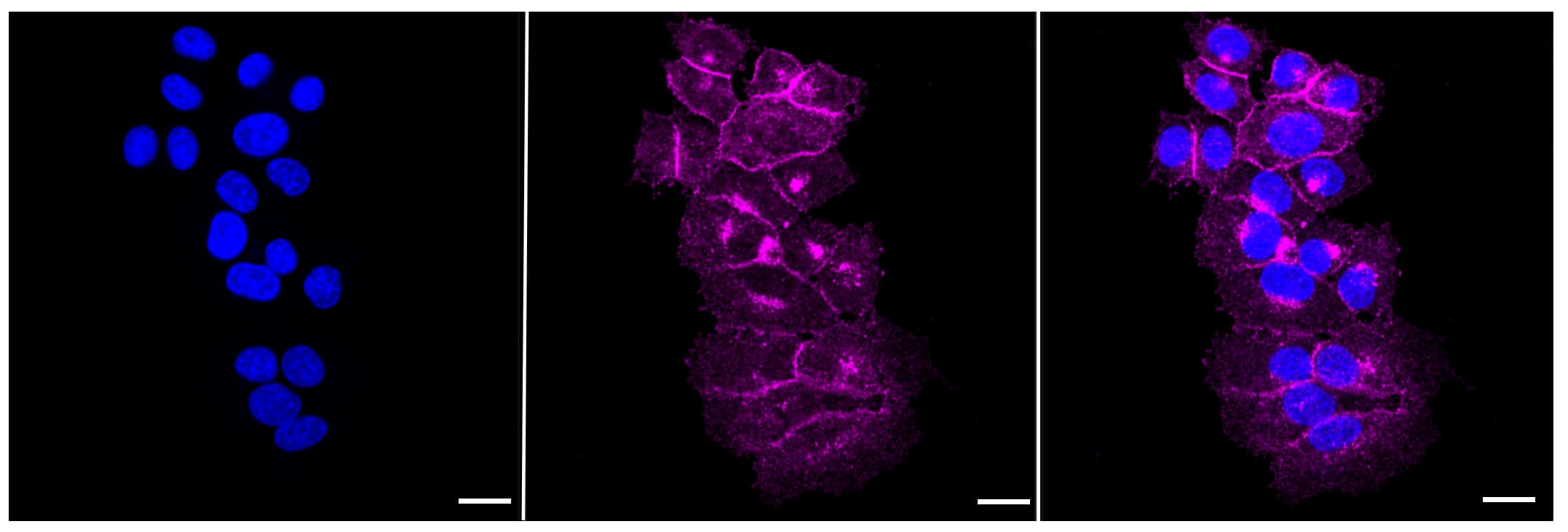 Flotillin-1 Antibody (23GB845)