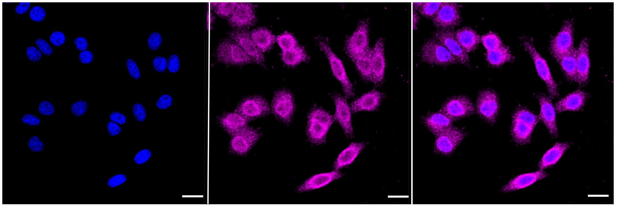 Ferritin Heavy Chain Antibody (23GB1835)