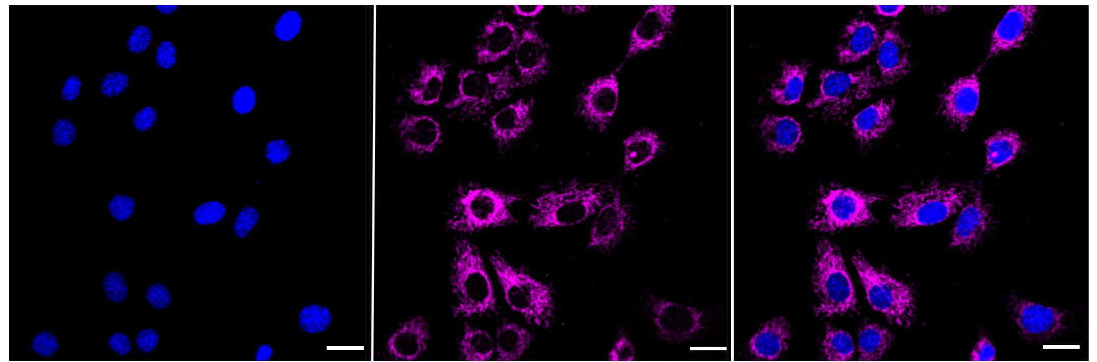 ACADS Antibody (23GB1365)