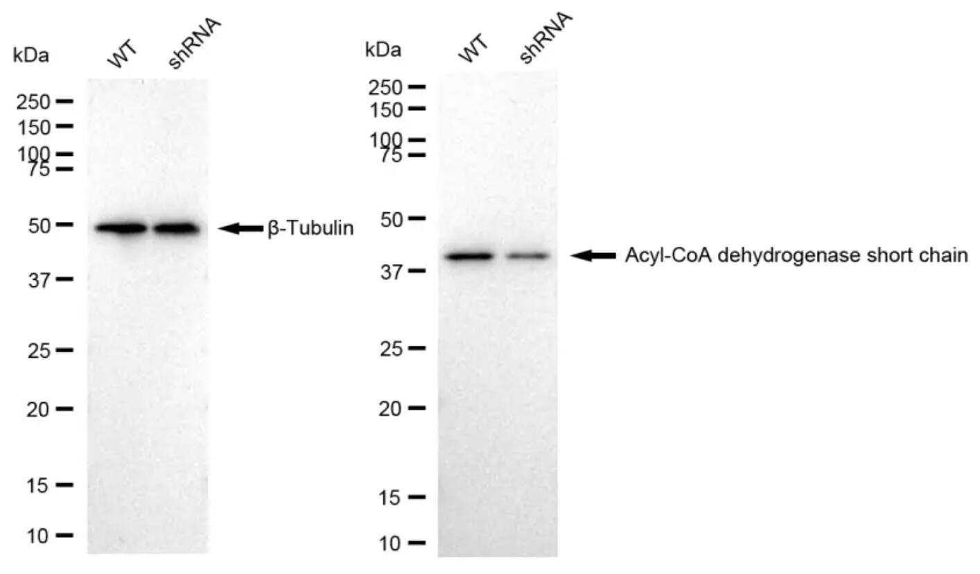 ACADS Antibody (23GB1365)