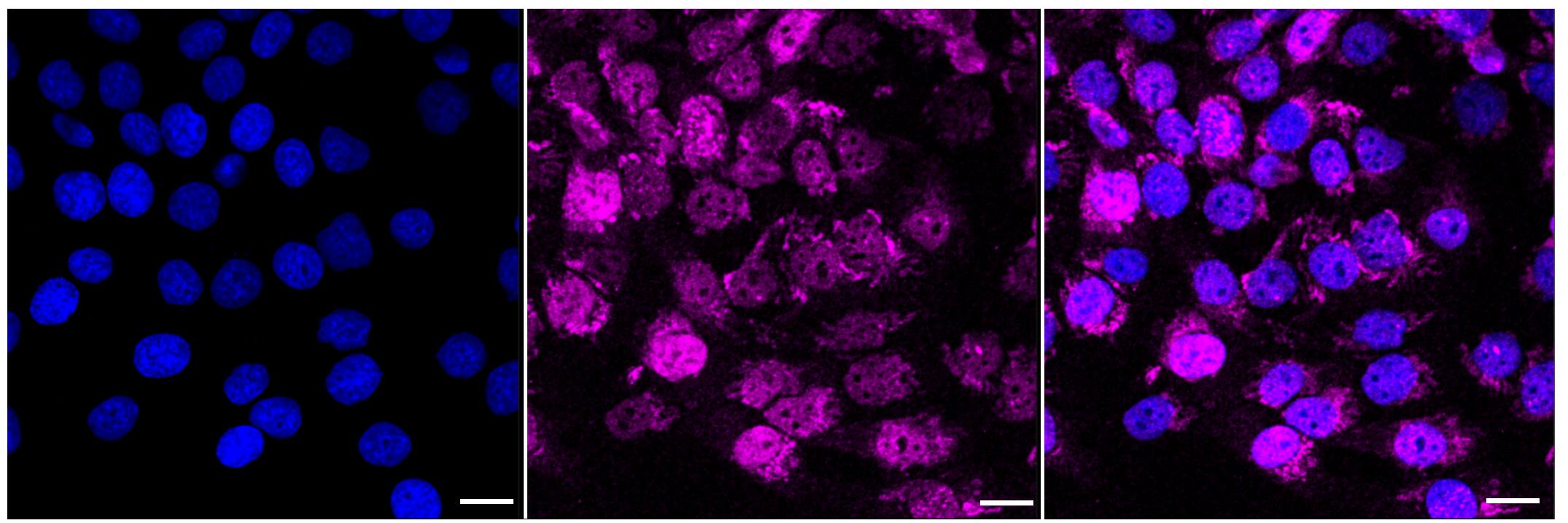 ACAT1 Antibody (23GB1255)