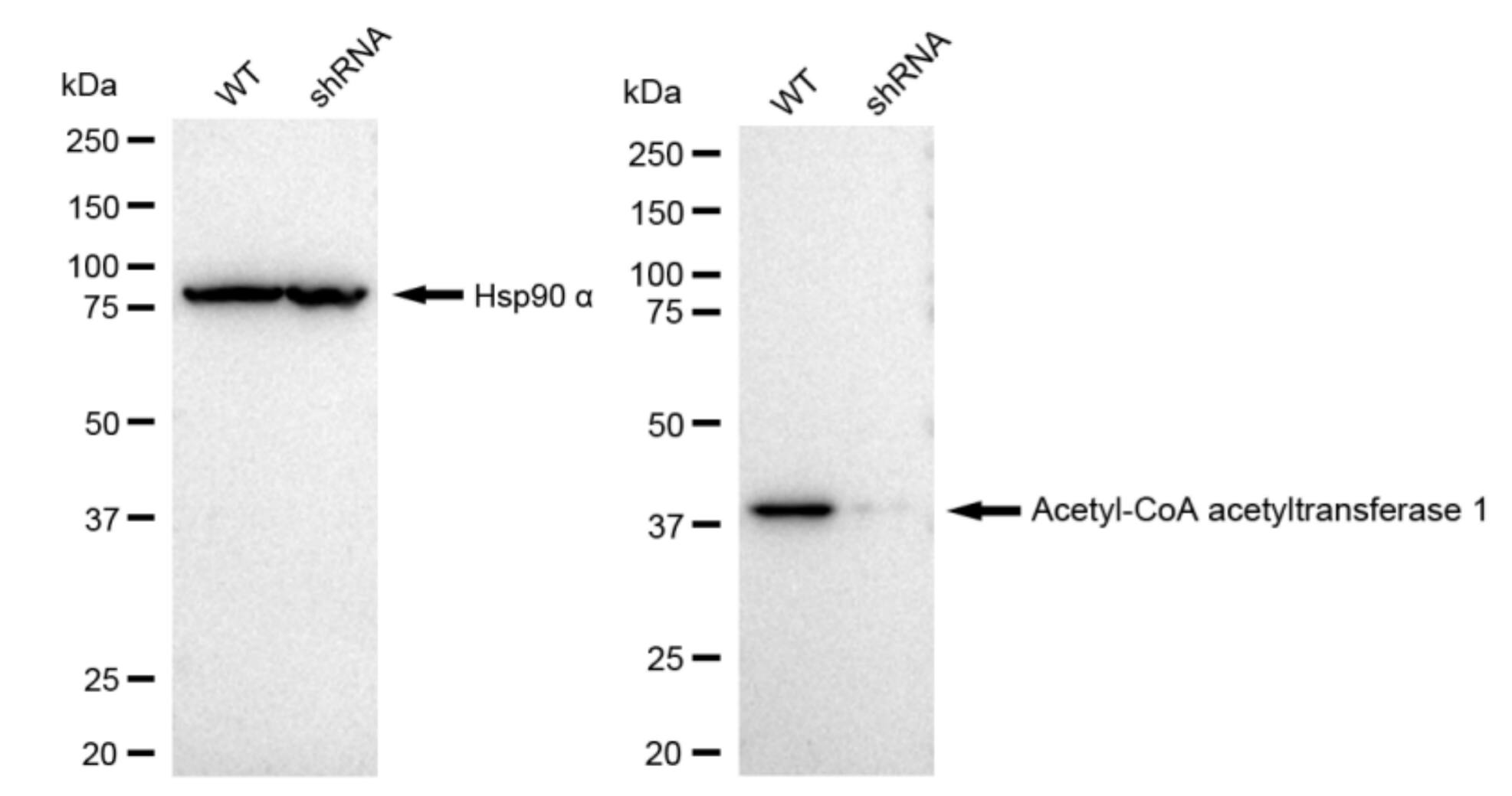 ACAT1 Antibody (23GB1255)