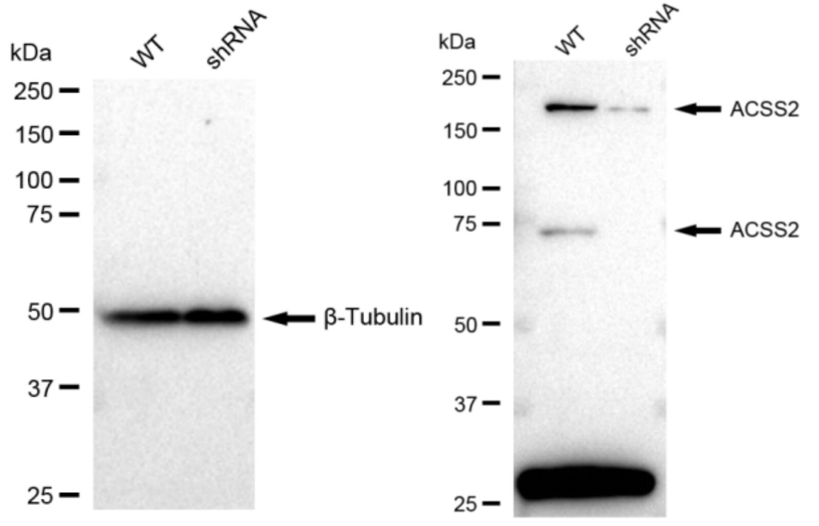 Acetyl CoA synthetase Antibody (23GB1705)
