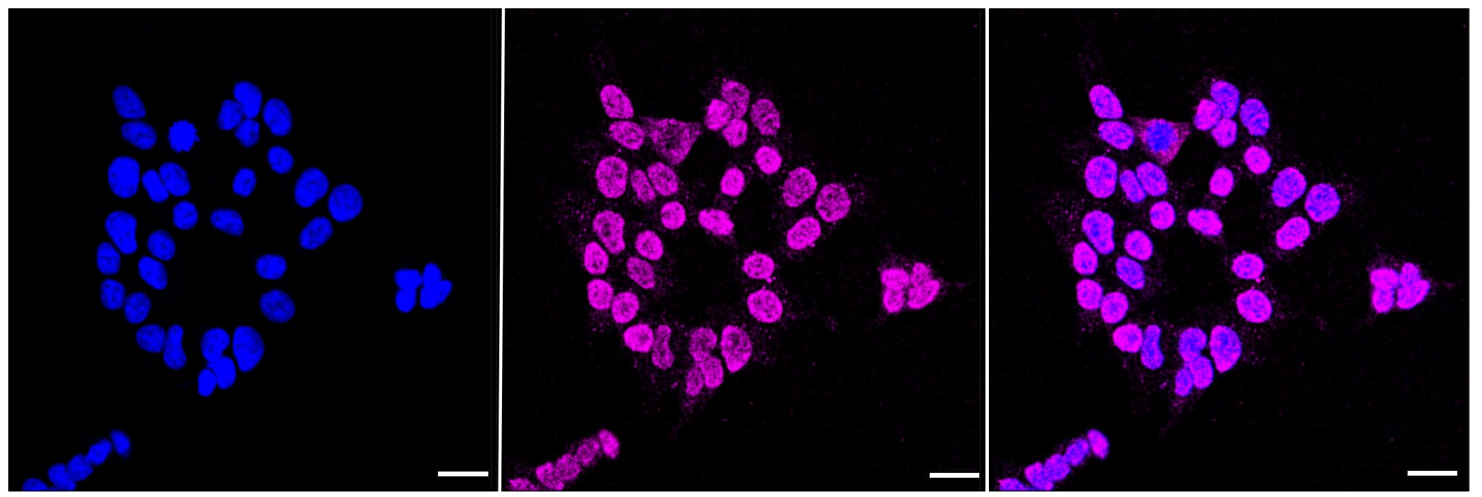 ADK Antibody (23GB625)