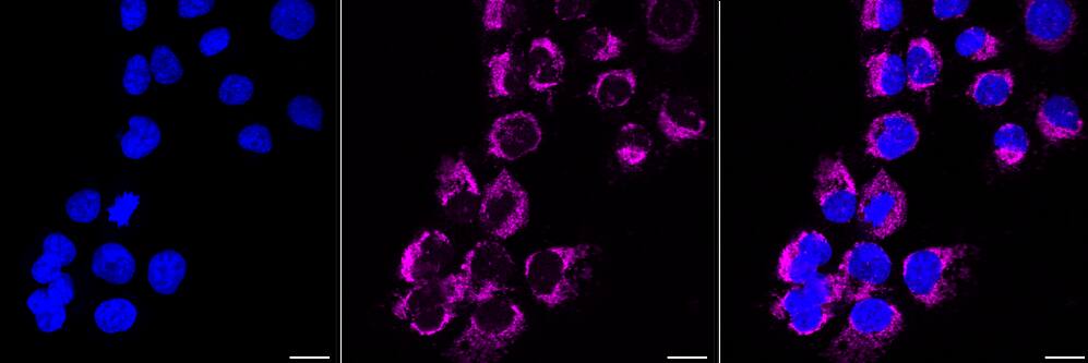 Hexokinase 1 Antibody (23GB870)