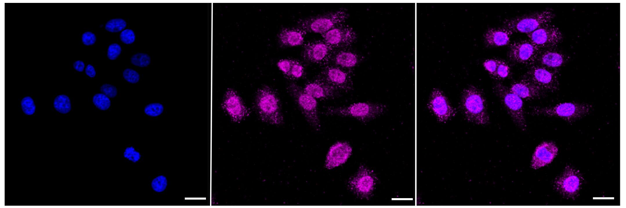 ABH1 Antibody (23GB1385)