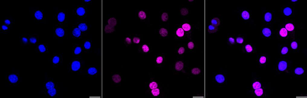 Cyclin D1 Antibody (23GB735)