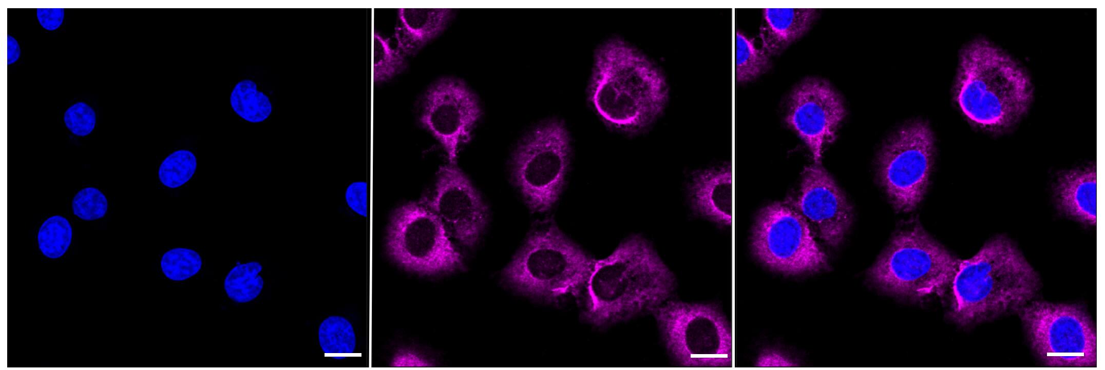 ARG2 Antibody (23GB655)