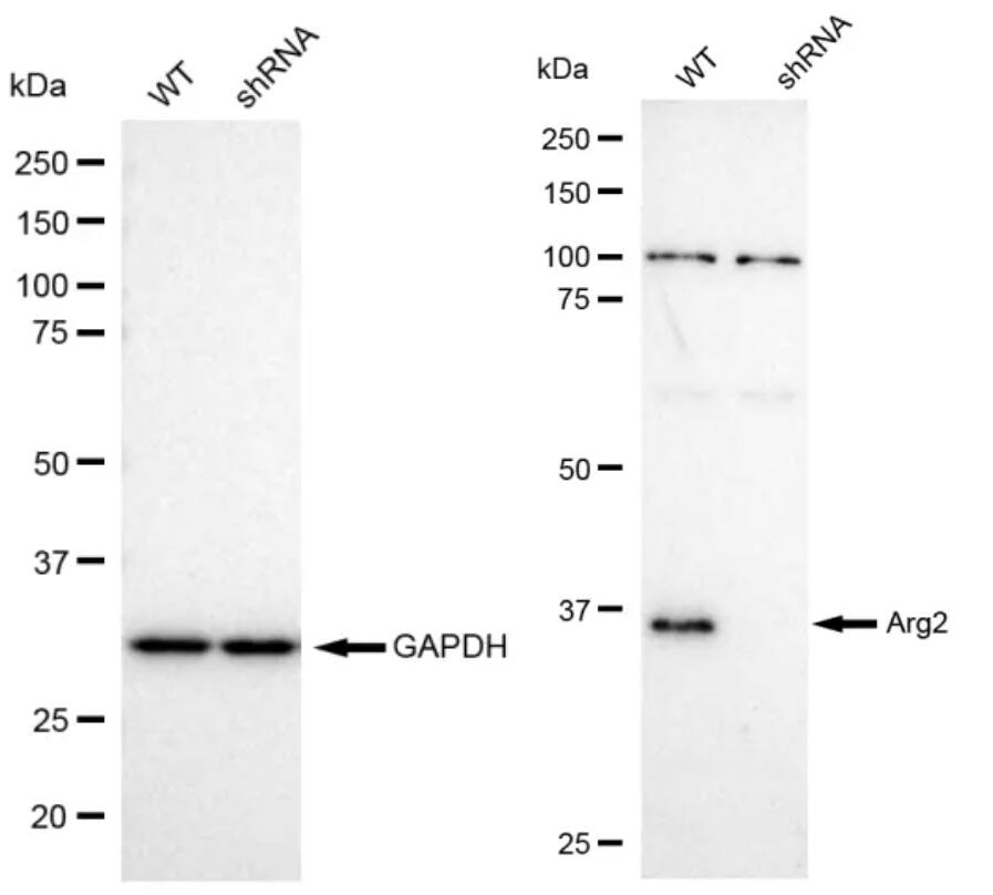 ARG2 Antibody (23GB655)