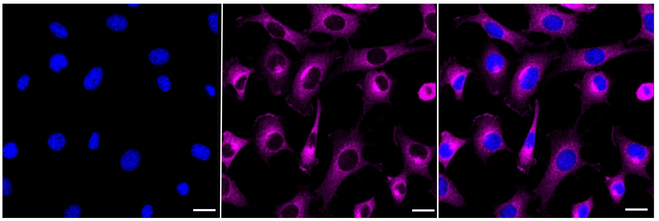 PKA C alpha Antibody (23GB1030)
