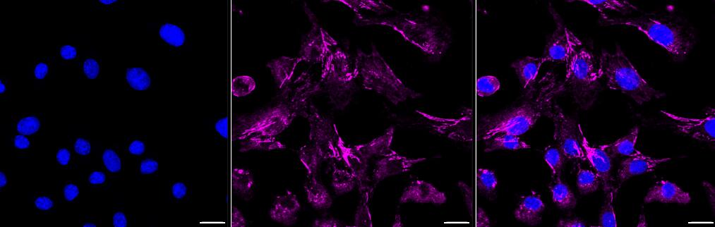 Integrin alpha 5/CD49e Antibody (23GB880)