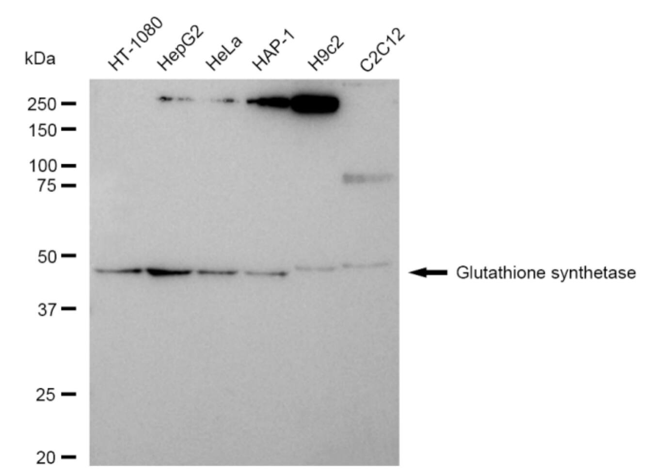 Glutathione Synthetase Antibody (23GB4385)