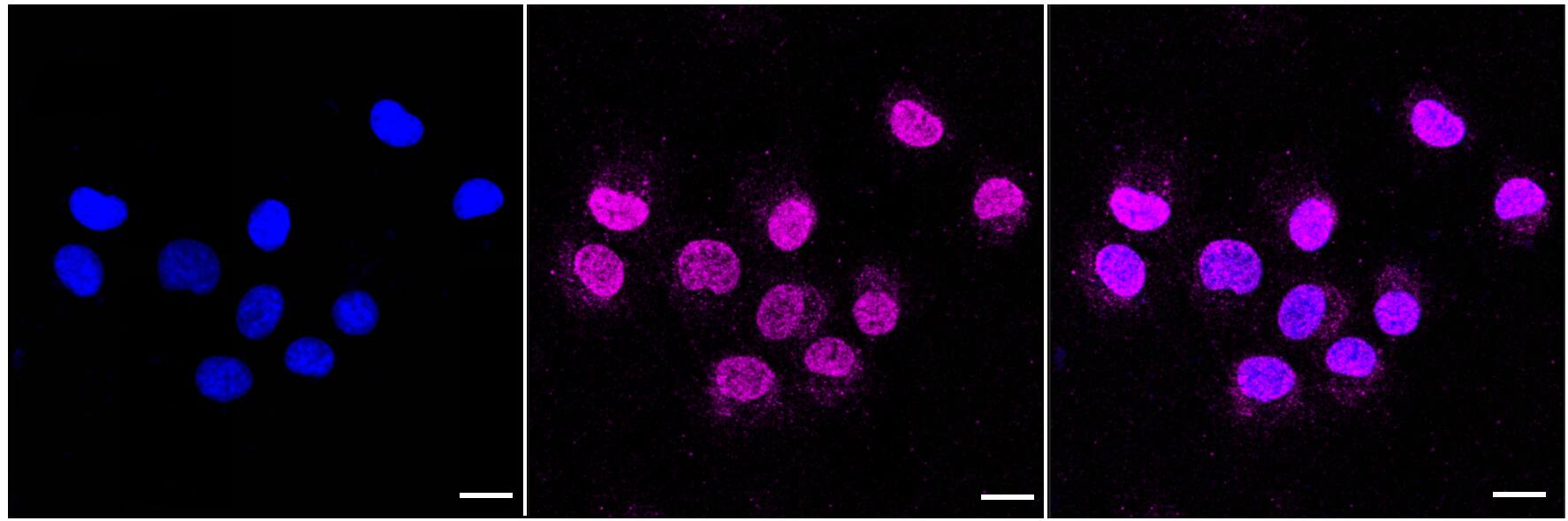 Cathepsin B Antibody (23GB1130)