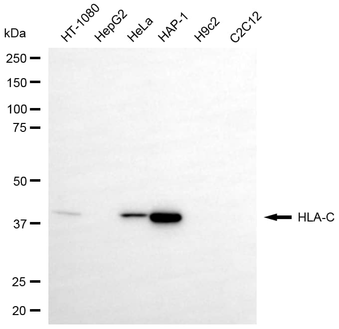HLA C Antibody (24GB8545)