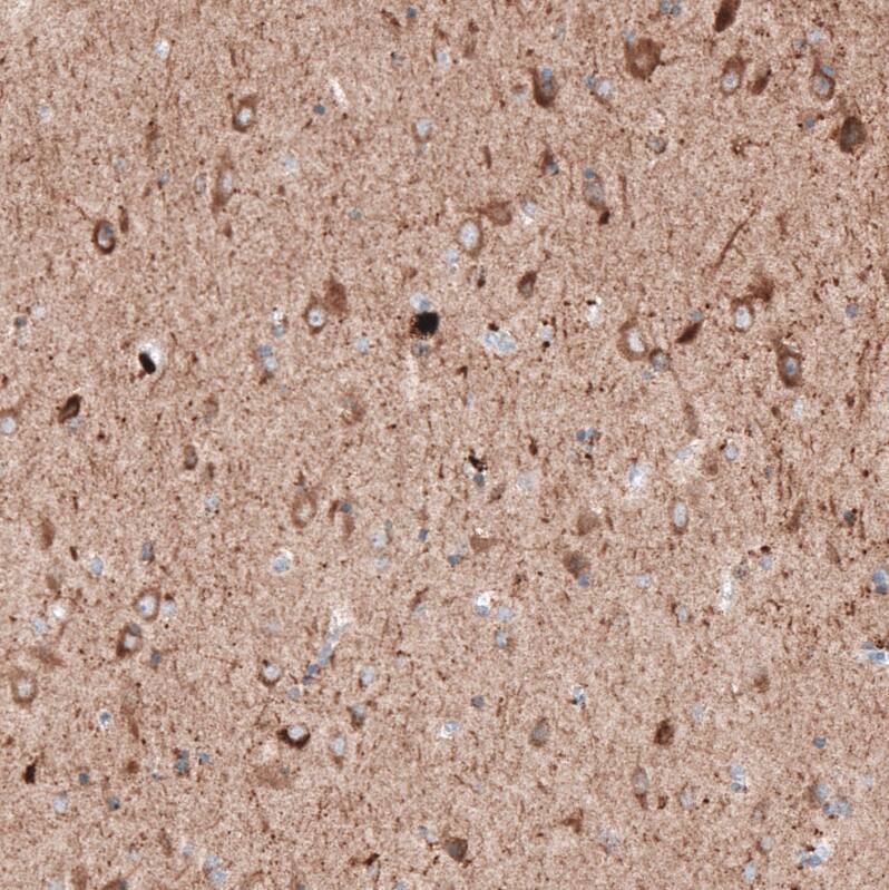 LAPTM4B Antibody (CL5289) Immunohistochemistry: LAPTM4B Antibody (CL5289) [NBP3-52052]