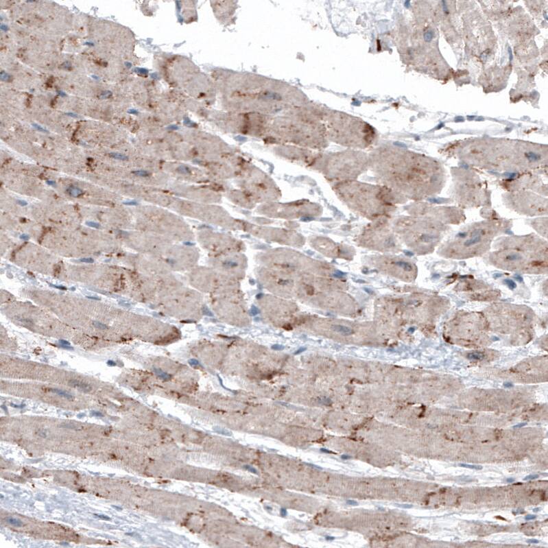 LAPTM4B Antibody (CL5289) Immunohistochemistry: LAPTM4B Antibody (CL5289) [NBP3-52052]