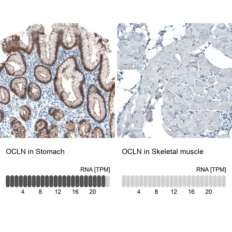 Occludin Antibody (CL1555) Immunohistochemistry: Occludin Antibody (CL1555) [NBP3-52053]
